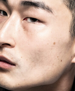 A close-up of a person's face highlights their left eye, eyebrow, and cheek. The skin appears smooth with natural pores and a few small moles. The eye is partially open, with a dark iris and lashes visible. The lips are relaxed and slightly parted, emphasizing the natural texture and tones of the face.